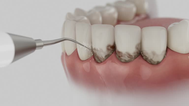 Reliable Dental Implants contractor in Kings Beach, CA by Smile Center Dentistry